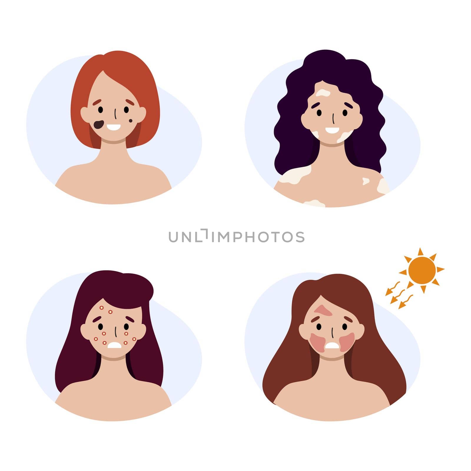 Women with various skin diseases. Sunburn and allergy symptoms on the face. by polinka_art