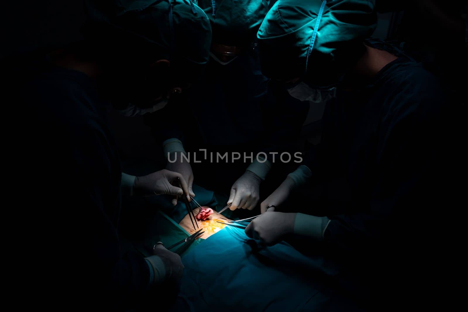 Surgical team performing surgery to patient in sterile operating room. In a surgery room lit by a lamp, a professional and confident surgical team provides medical care to an unconscious patient.