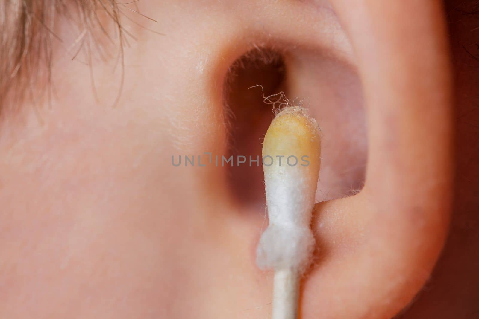 Cleaning the ear with a cotton swab. The process of cleaning the ears close-up, yellow cotton swab with dirt from the ear. Mother cleaning baby's ear, with copy space.