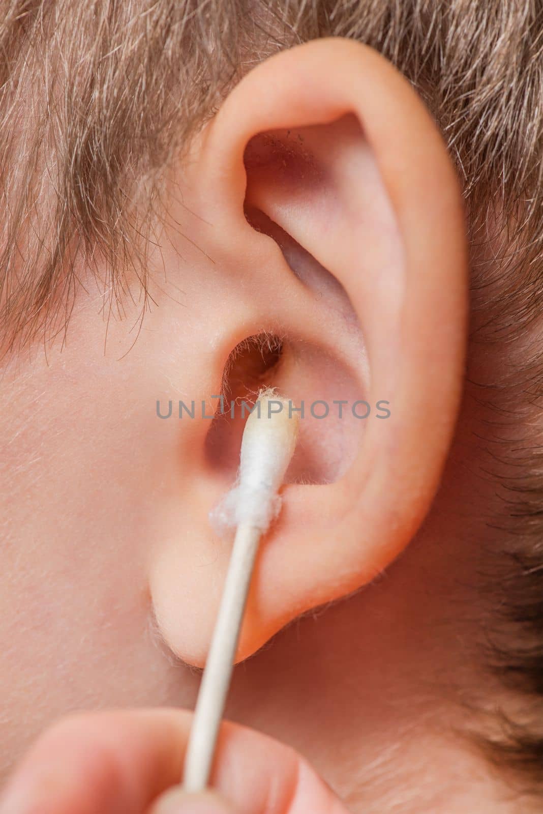 Cleaning the ear with a cotton swab. The process of cleaning the ears close-up, yellow cotton swab with dirt from the ear. Mother cleaning baby's ear, with copy space by SERSOL