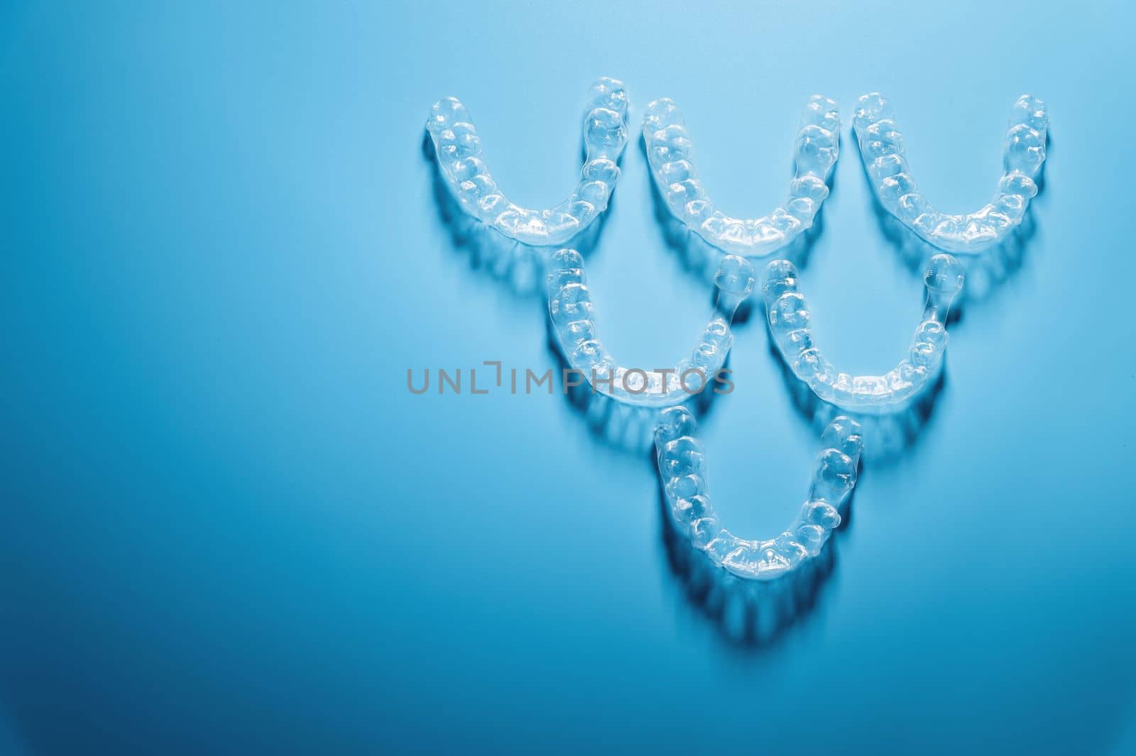 transparent straighteners for teeth in the shape of a pyramid on a blue background, dentistry and orthodontics. 3D printing in modern medicine.