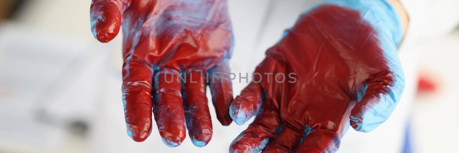 Surgeon in blue gloves with blood. Evaluation of severity of blood loss in surgical practice concept