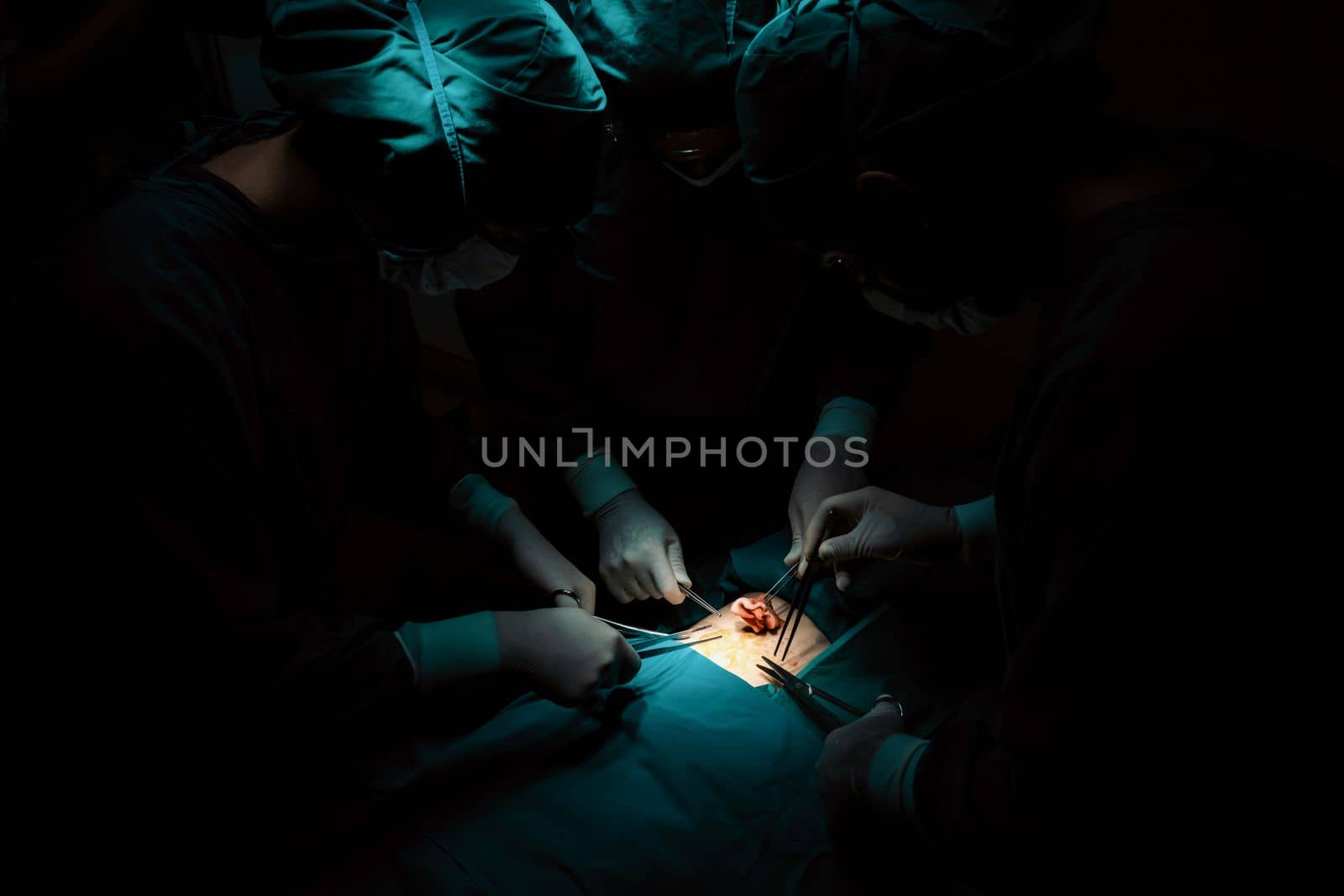 Surgical team performing surgery to patient in sterile operating room. In a surgery room lit by a lamp, a professional and confident surgical team provides medical care to an unconscious patient.