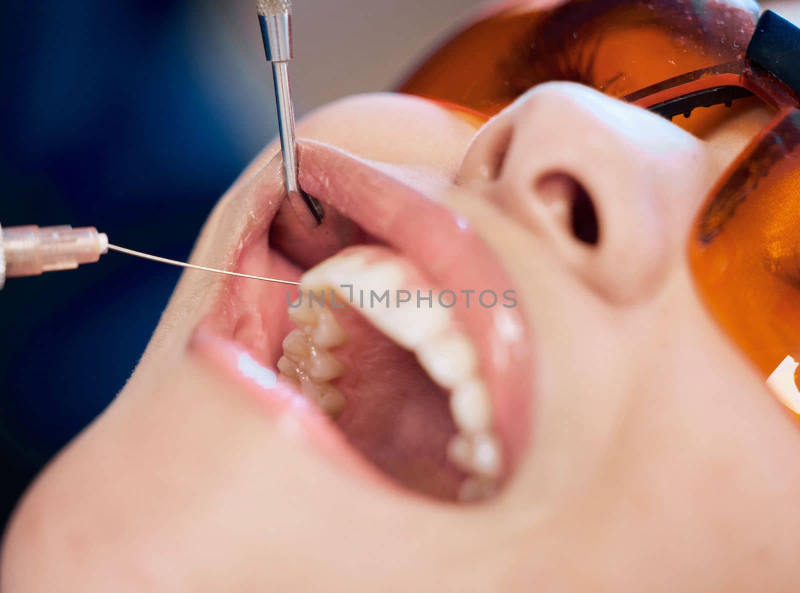 The worst part of the process. a woman receiving an injection at the dentists office