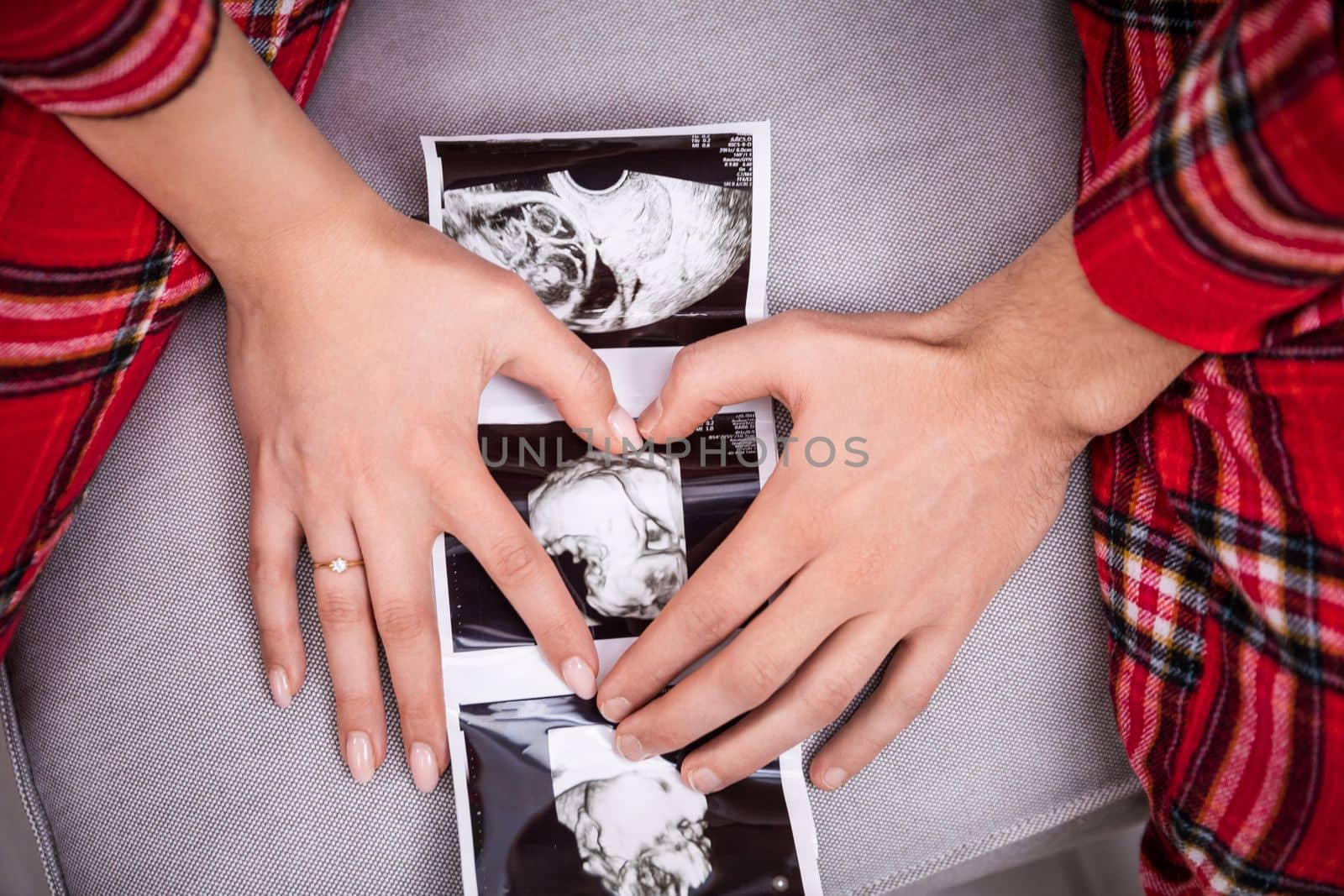 An usg photo of a baby lies on a gray sofa. A woman and a man put their hands on the usg photo, forming a heart shape from their palms. The parents-to-be are wearing the same plaid pajamas.
