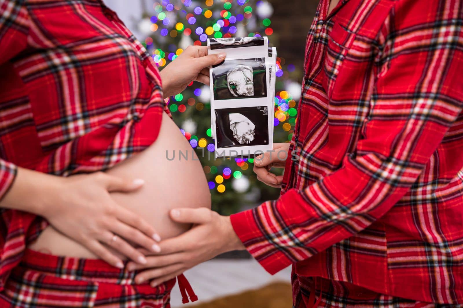 In the foreground, the torso of a woman and a man facing each other. The woman is advanced in pregnancy and exposes her belly. The couple jointly hold an usg photo of the baby, visible in the background.