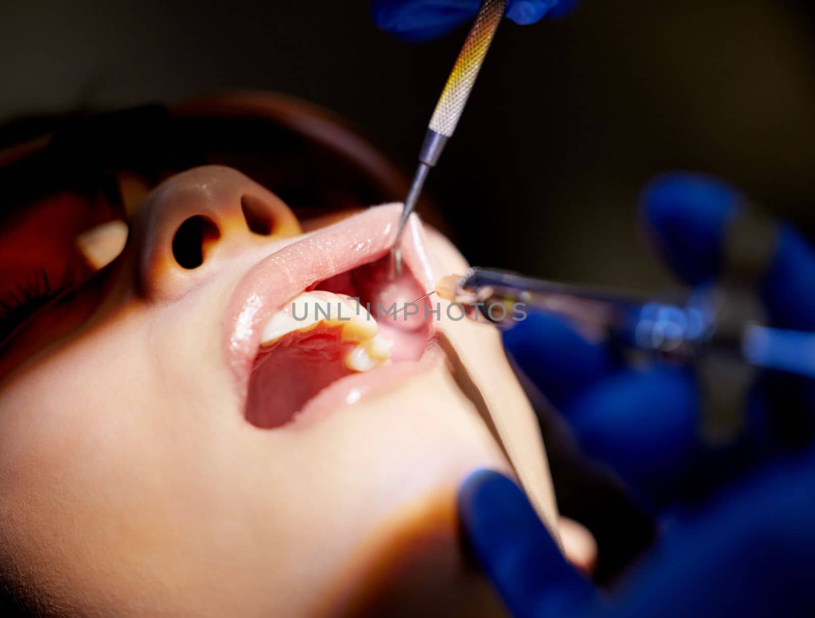 Open wide for expert dental work. a young woman having a dental procedure performed on her