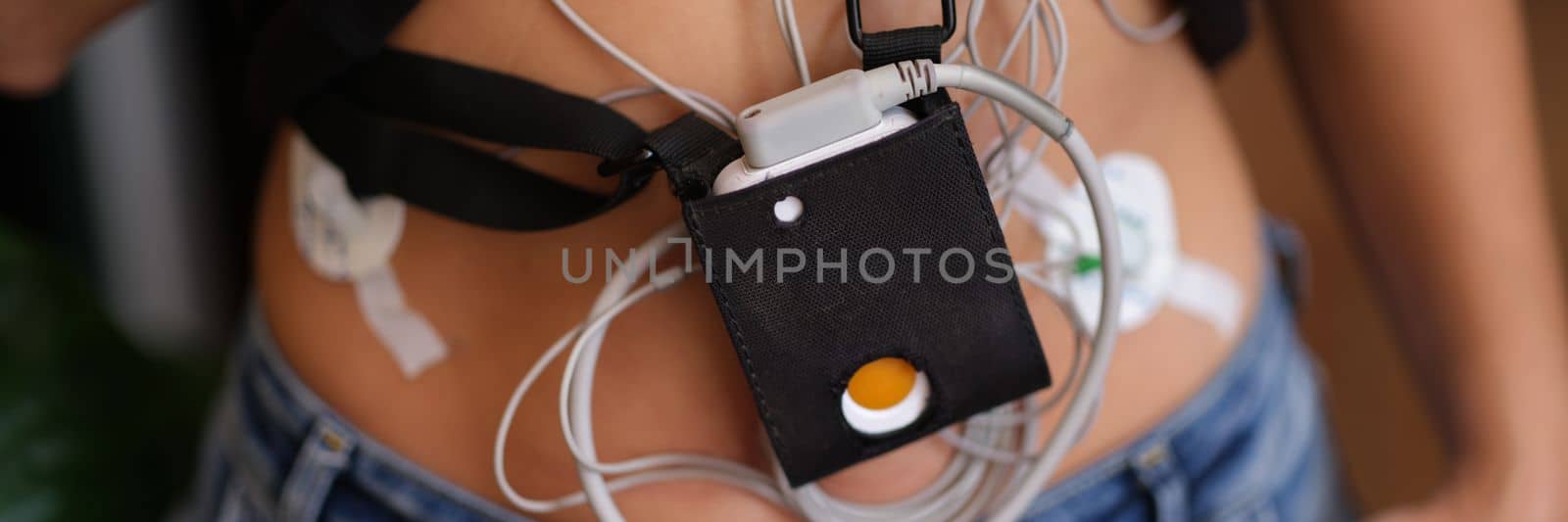Patient standing with holter electrocardiogram monitor closeup. Diagnosis of arrhythmia and coronary heart disease concept