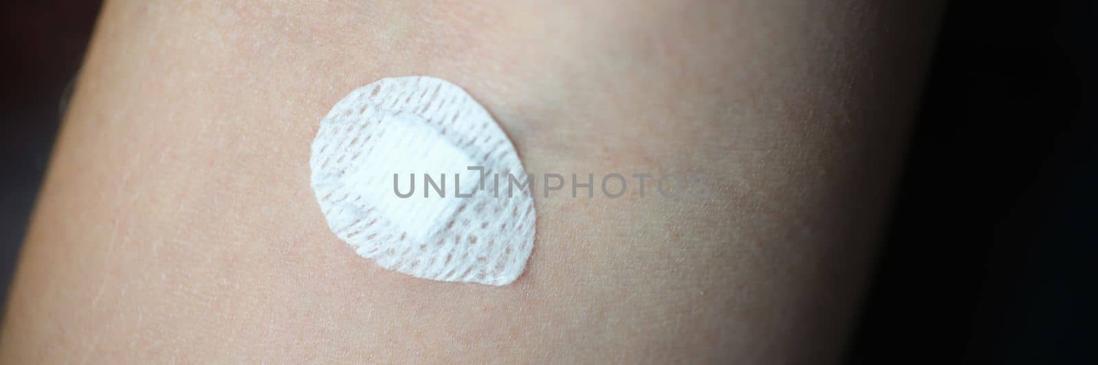 Small round patch stuck in place intravenous injection on forearm closeup. Medical laboratory blood tests concept