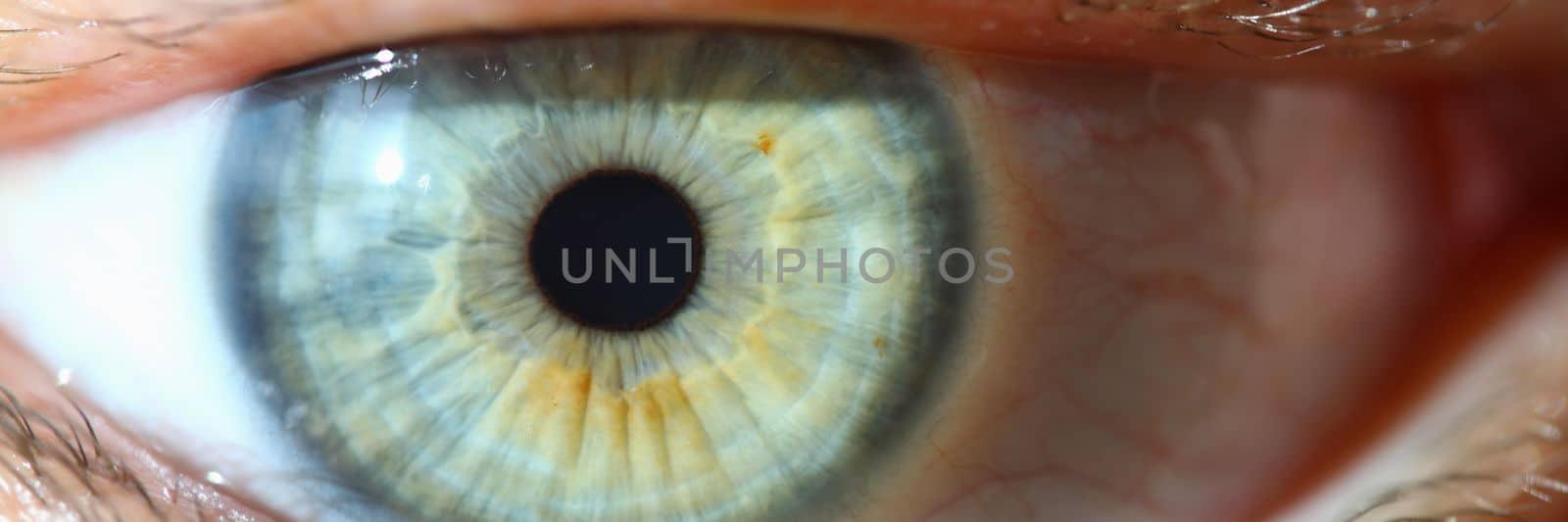 Closeup of human eye and macro photography. Hyperopia, myopia, astigmatism and laser vision correction