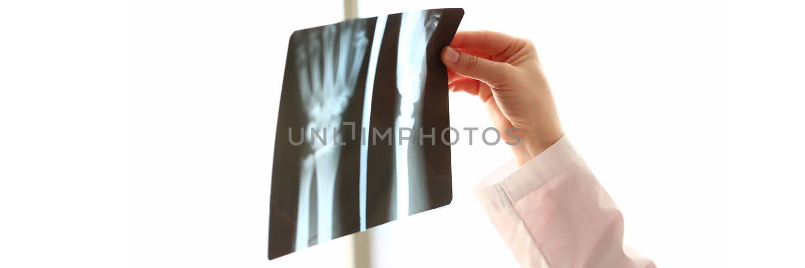 Orthopedic doctor examines image of hands on x-ray. Pain in joints of arm concept