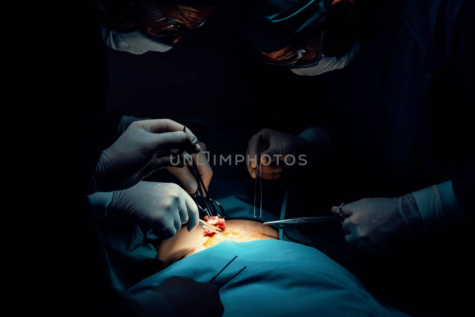 Surgical team performing surgery to patient in sterile operating room. In a surgery room lit by a lamp, a professional and confident surgical team provides medical care to an unconscious patient.