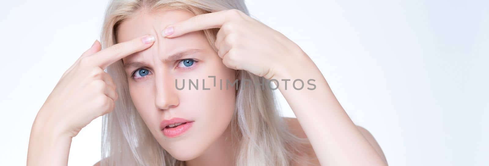 Acne problem troubling closeup personable worried woman with natural beauty skin checking her face squeezing pimple spots in isolated background. Copyspace for blemish skincare treatment problem.