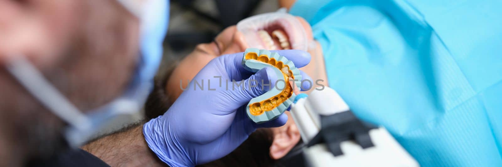 Dentist holds cast with veneers on plaster model and patient in dental clinic. Taking impressions for making veneers concept