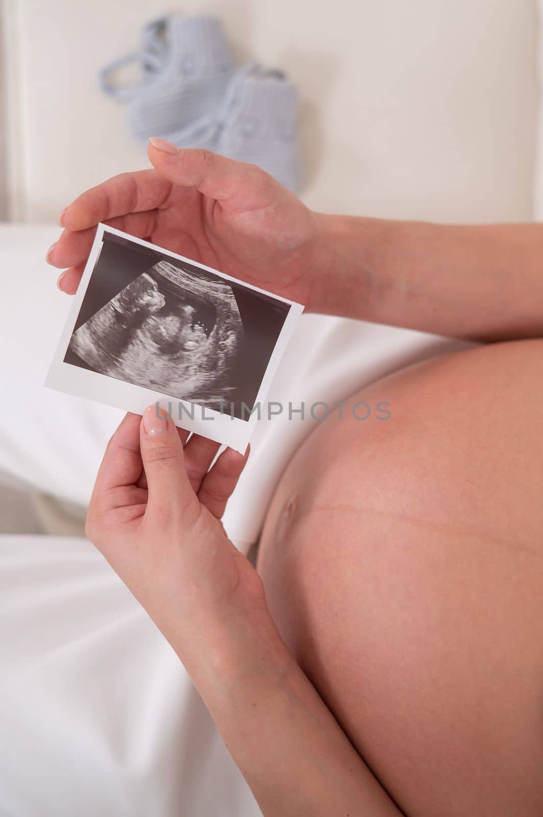 A faceless pregnant woman sits on a white sofa and holds an ultrasound photo of the fetus. by mrwed54