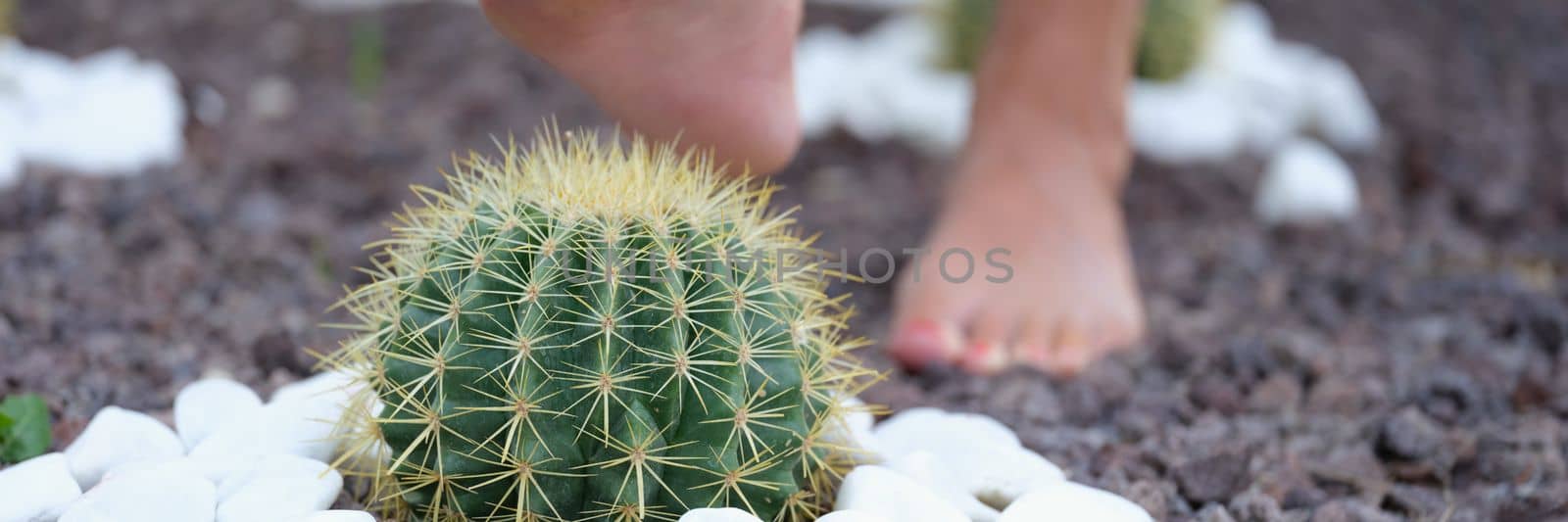 Human leg with painful heel and cactus thorns pierce a woman leg. Leg health and foot pain concept