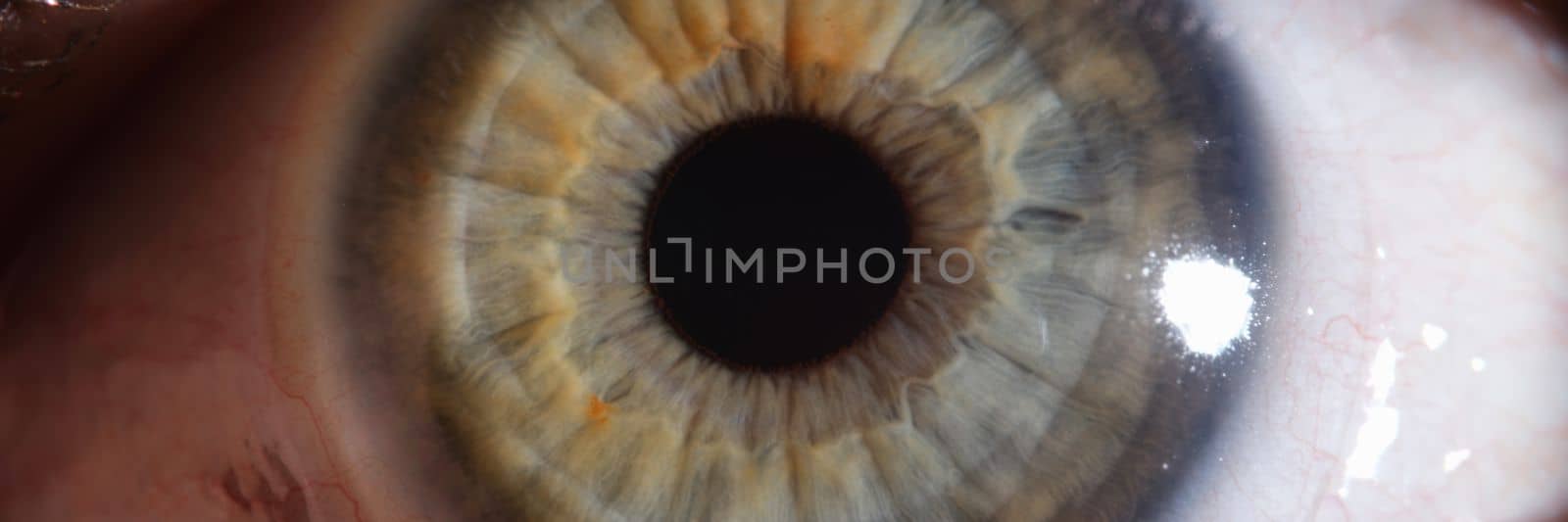 Closeup of red damaged or irritated eye by kuprevich