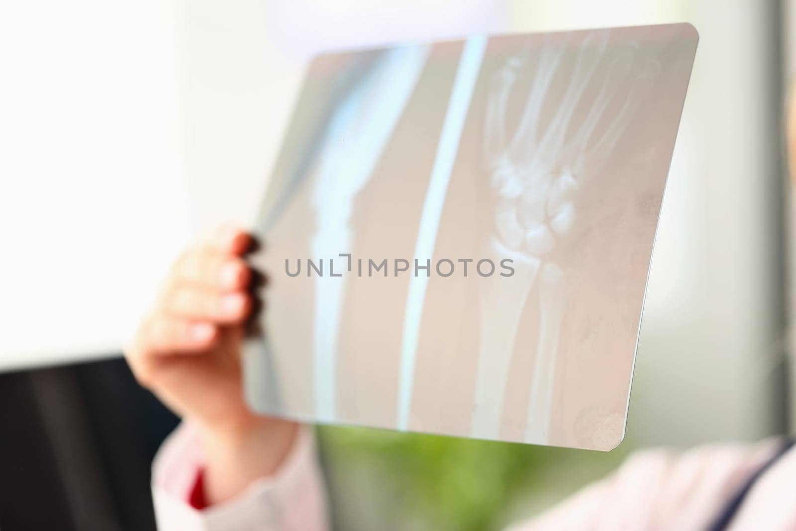 Doctor holds in hands x-ray of arm. Medical assistance during examination of the bones of wrist