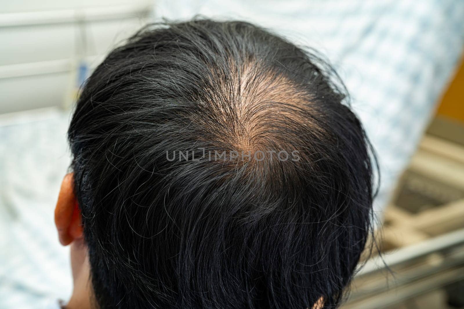 Bald in the middle head and begin no loss hair glabrous of mature Asian business smart active office man. by pamai