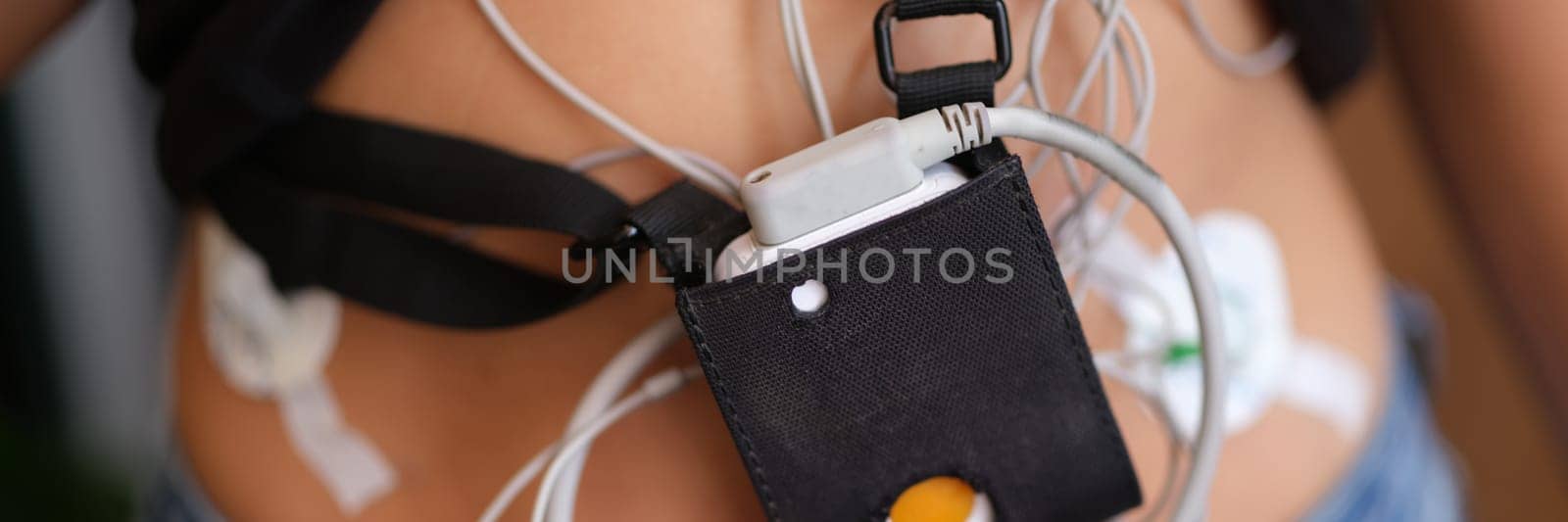 Ecg holter monitor hanging on patient body closeup by kuprevich