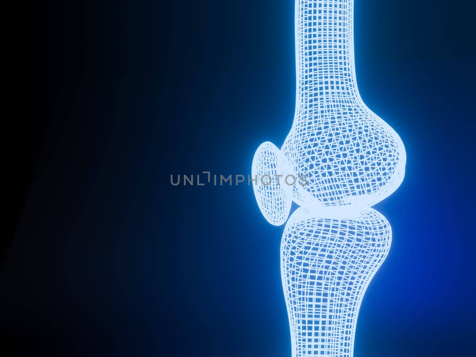 Knee joint 3D rendering Blue glowing wireframe on black background with copy space for text. Bone human skeleton anatomy of the body. Medical health care science concept. Realistic 3D Rendering. by samunella