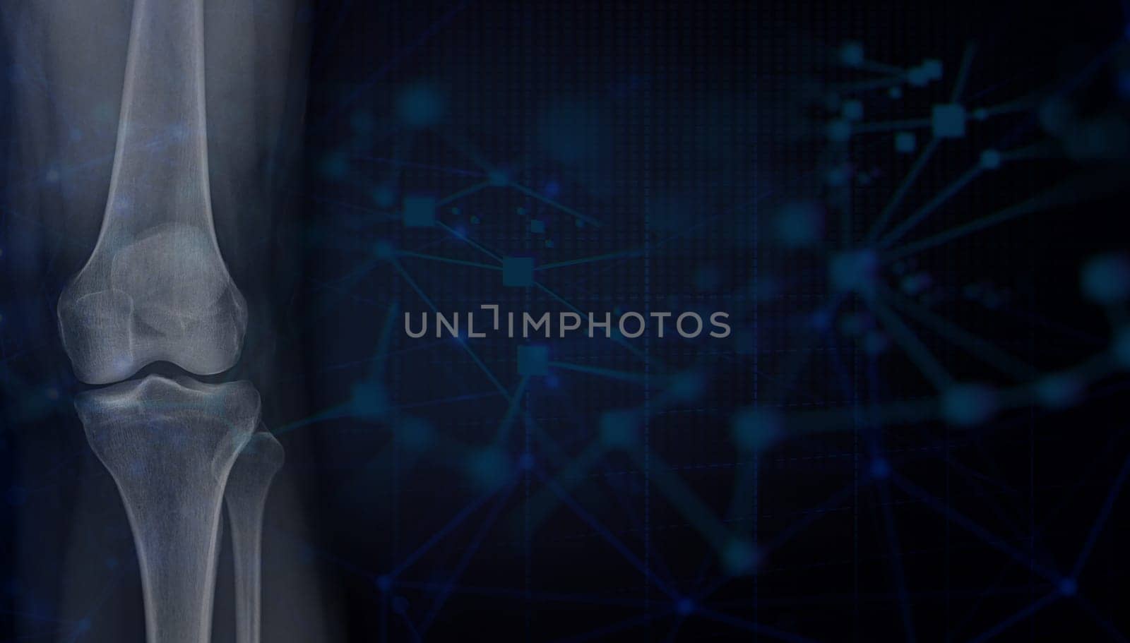 Film x-ray of Left knee joint AP view for Medical background 3D rendering.