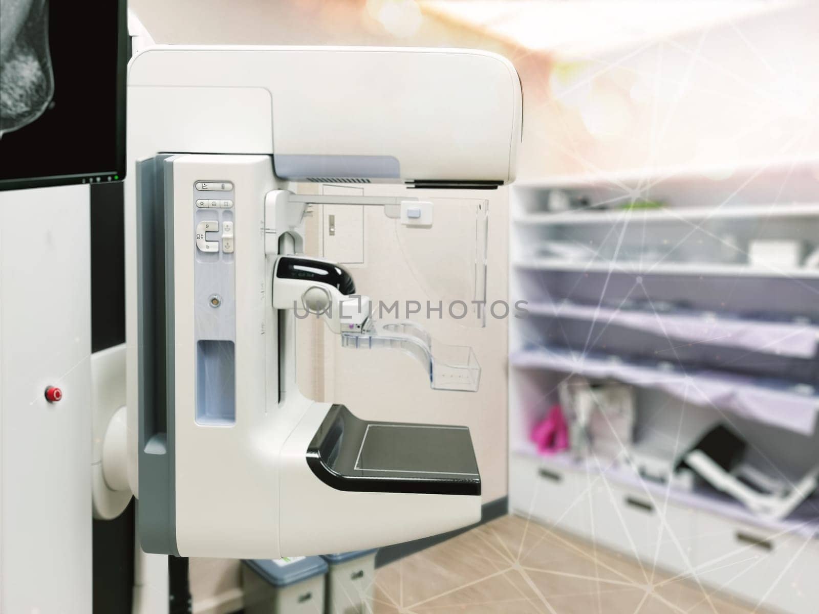 Mammography machine with monitor for breast screening device on mammogram room background. by samunella