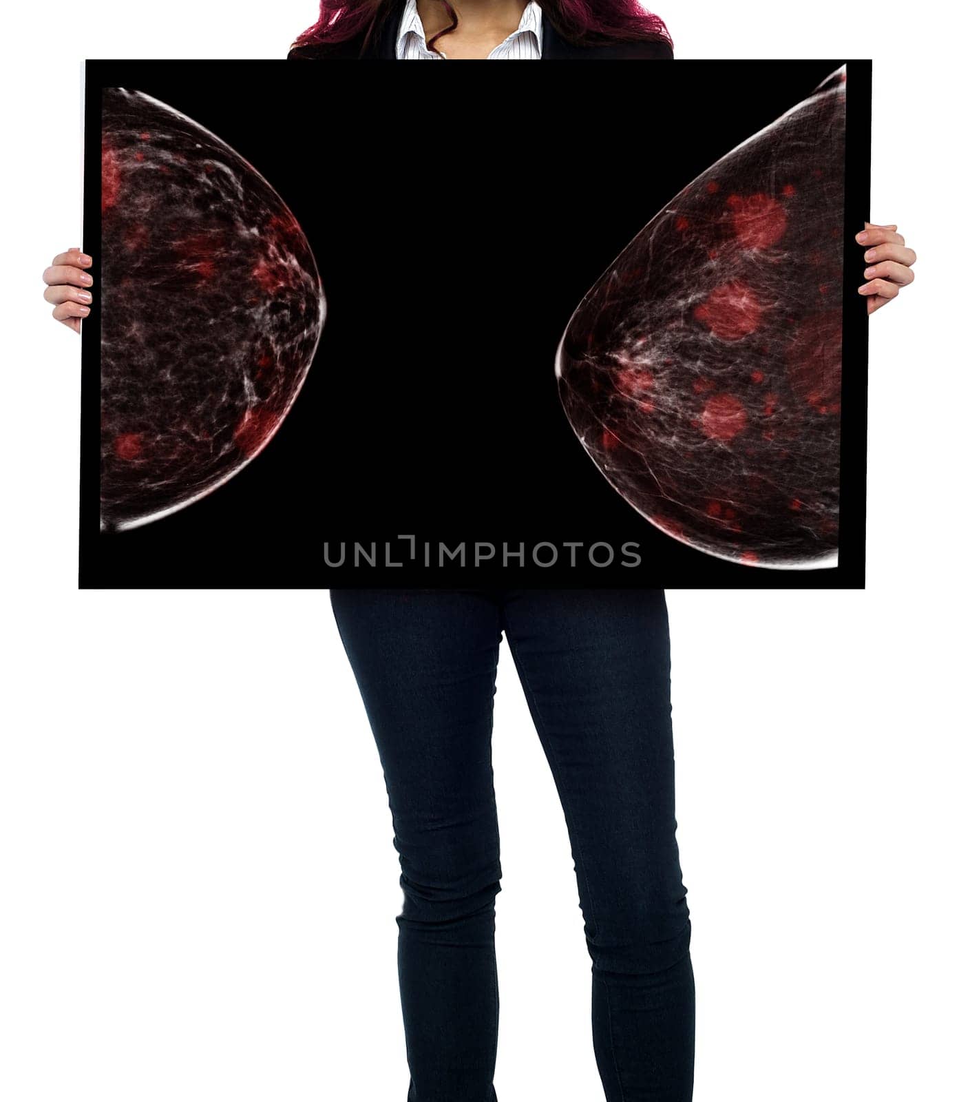 breast cancer awareness against woman for fight against breast cancer showing X-ray Digital Mammogram isolated on white background. Clipping path.