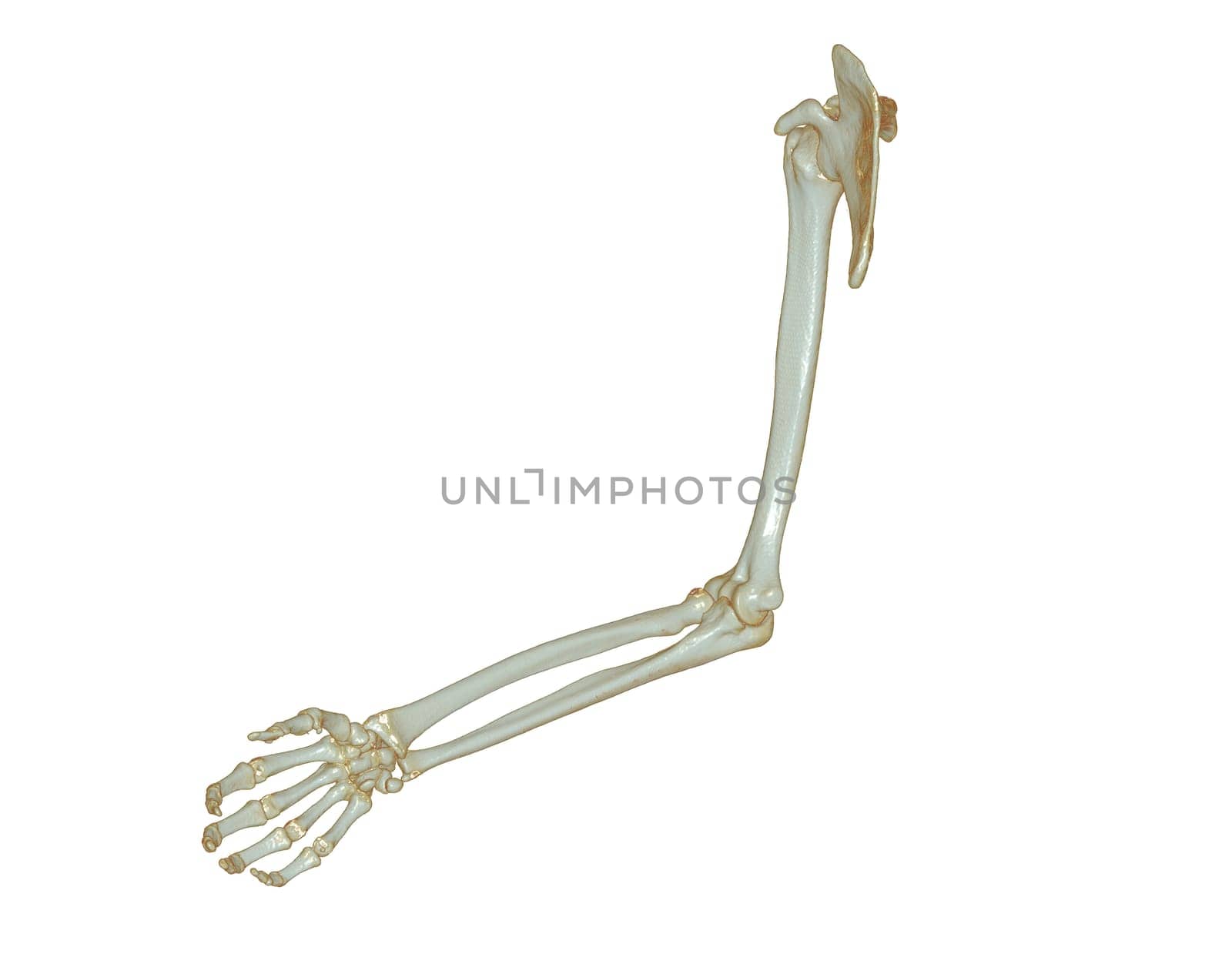 CT SCAN of Upper extremity 3D rendering isolated on white background .Clipping path. by samunella