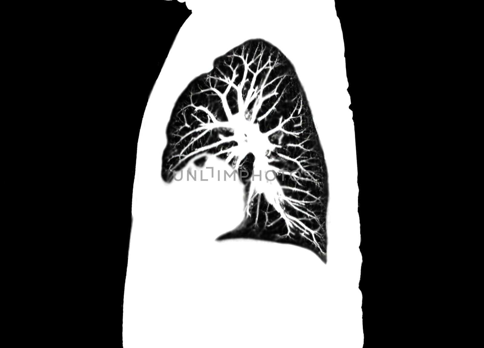 CT scan of Chest or lung sagittal view at radiology department in hospital. Covid-19 scan body xray test detection for covid virus epidemic spread concept