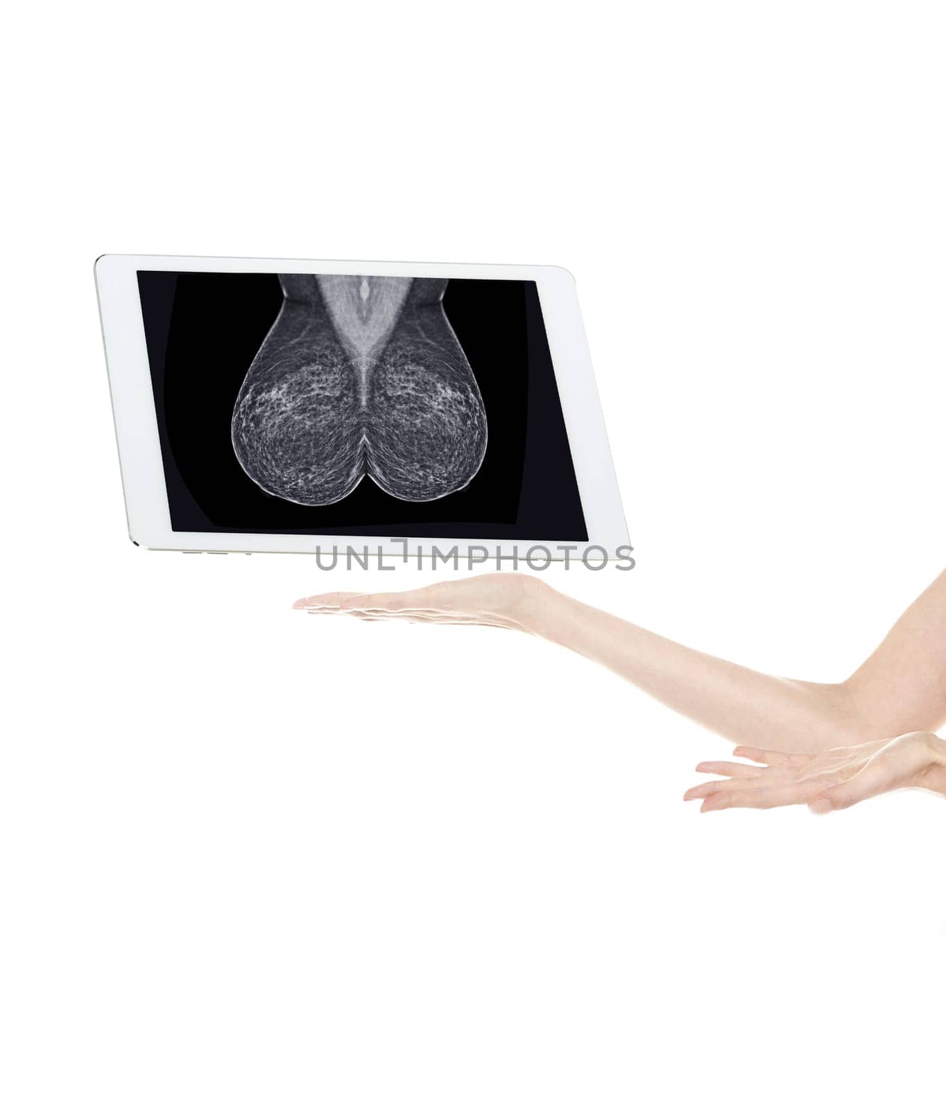 The doctor using digital tablet against X-ray Digital Mammogram isolated on white background. breast cancer awareness against woman for fight against breast cancer .