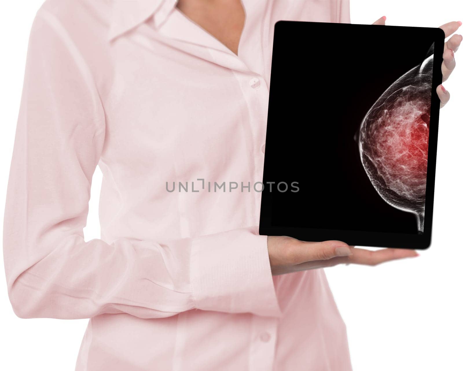 The doctor using digital tablet against X-ray Digital Mammogram isolated on white background.