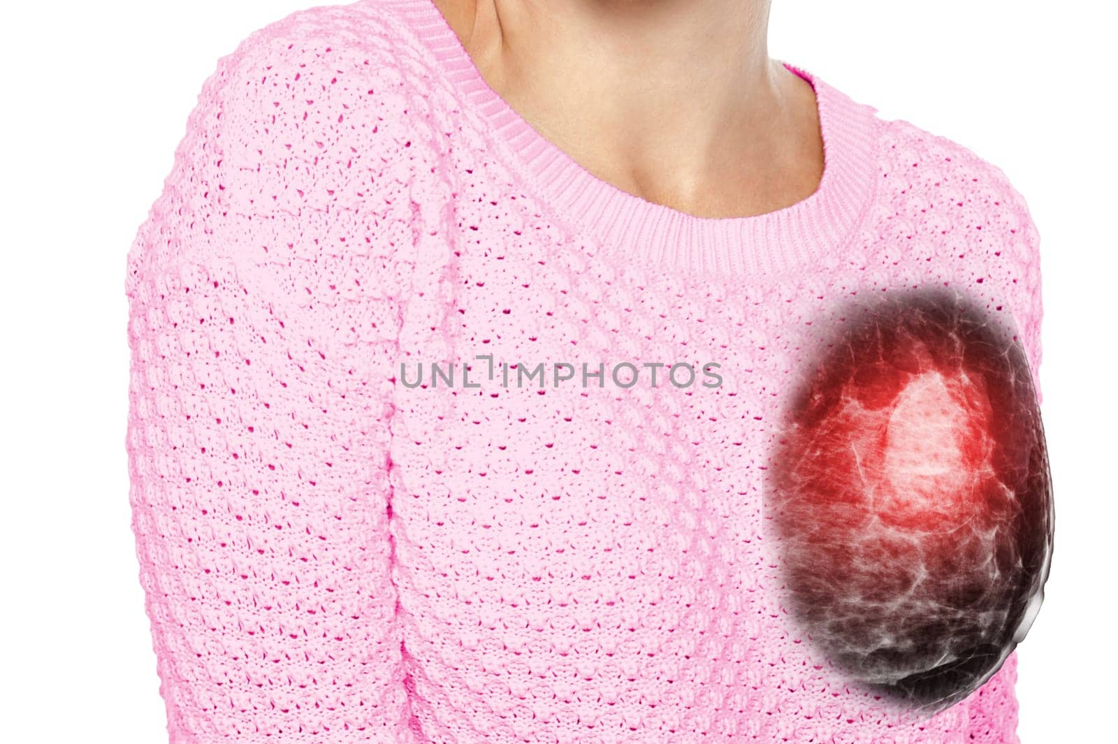 breast cancer awareness against woman for fight against breast cancer ,Mammogram image on the Left side chest of woman