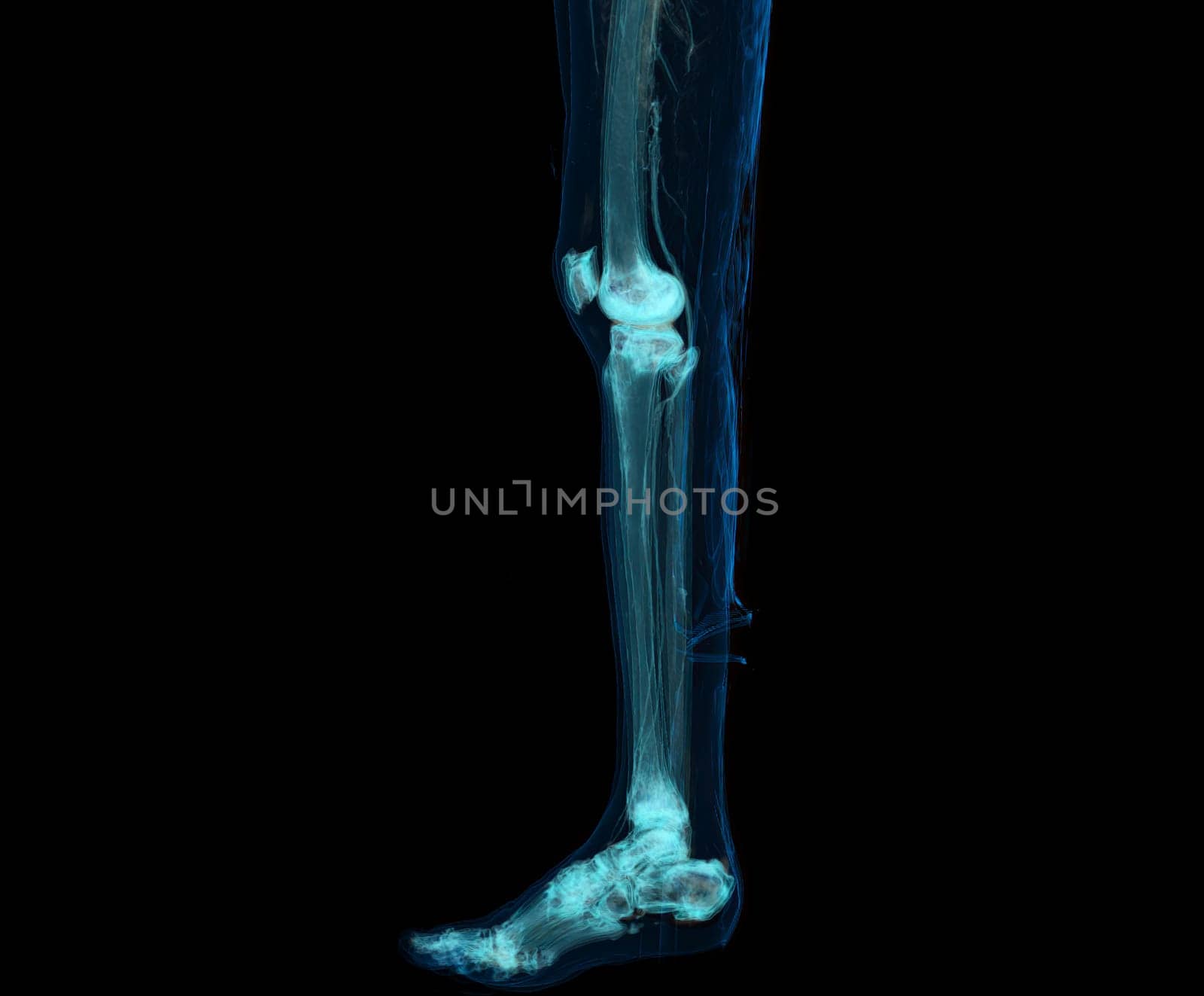 3D render of lower extremity or legs isolated on black background.