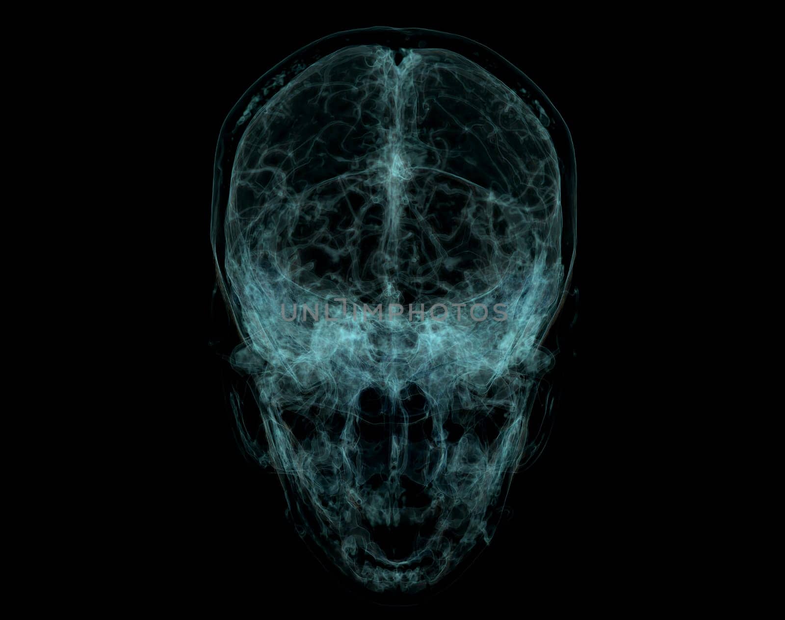 Human Skull, Brain by CT Scan. X-ray Visualization Inside Of Skull. 3D Illustration Render by samunella