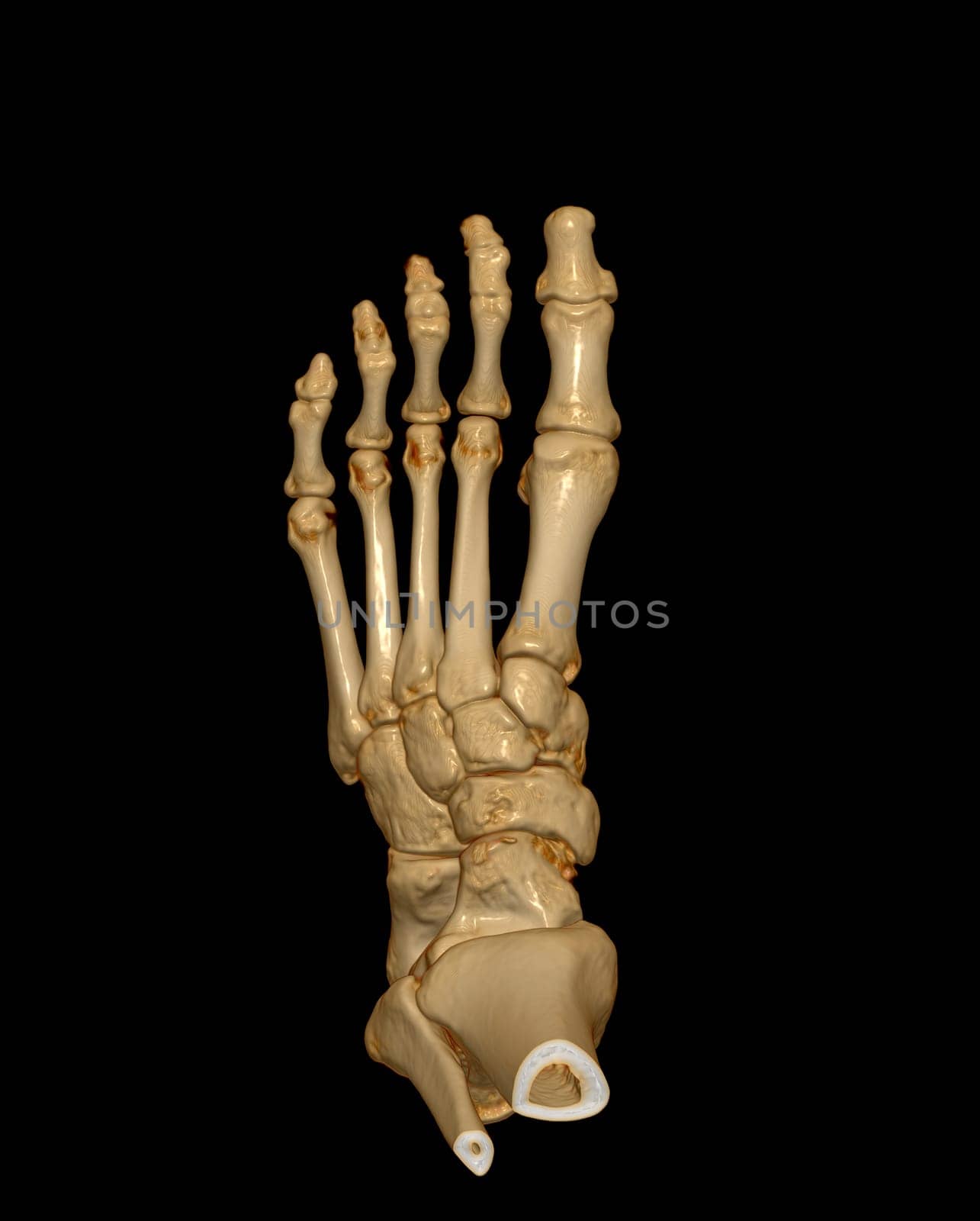 3D rendering of the foot bones for diagnosis bone fracture and rheumatoid arthritis from CT scannner.
