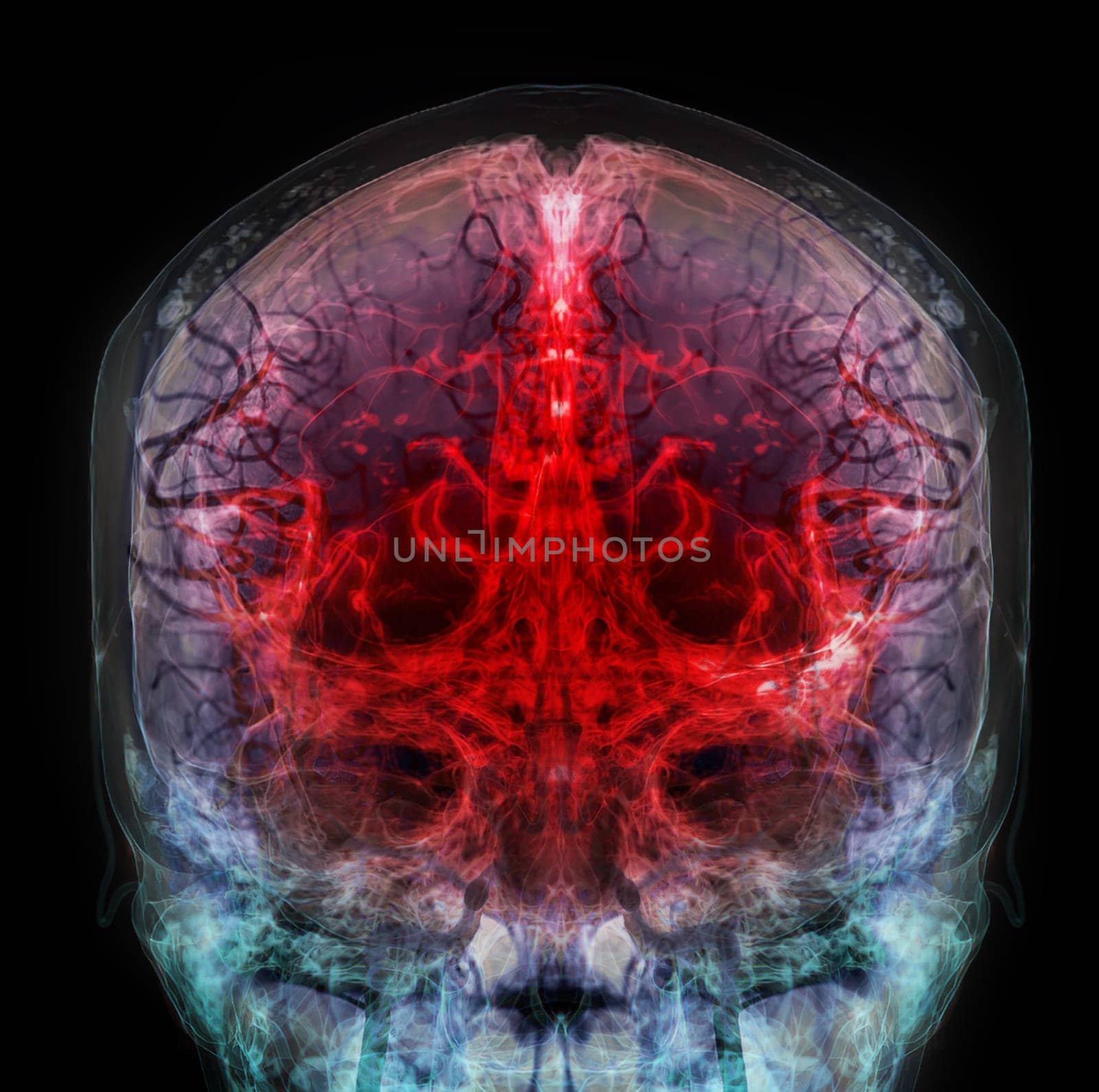 3D rendered medically accurate illustration of the cerebral artery of the head