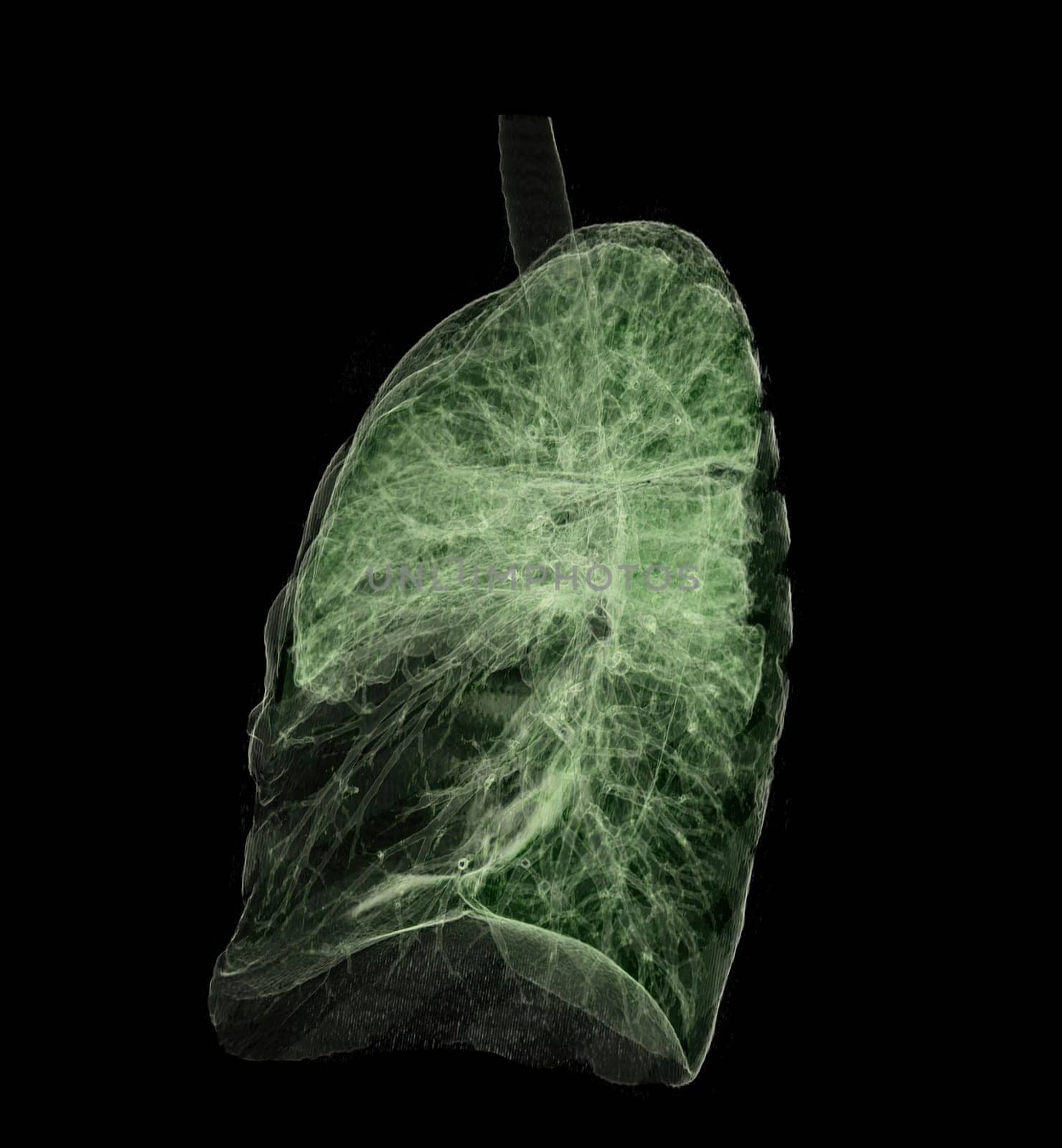 CT Chest or Lung 3D rendering image for diagnosis TB,tuberculosis and covid-19 .
