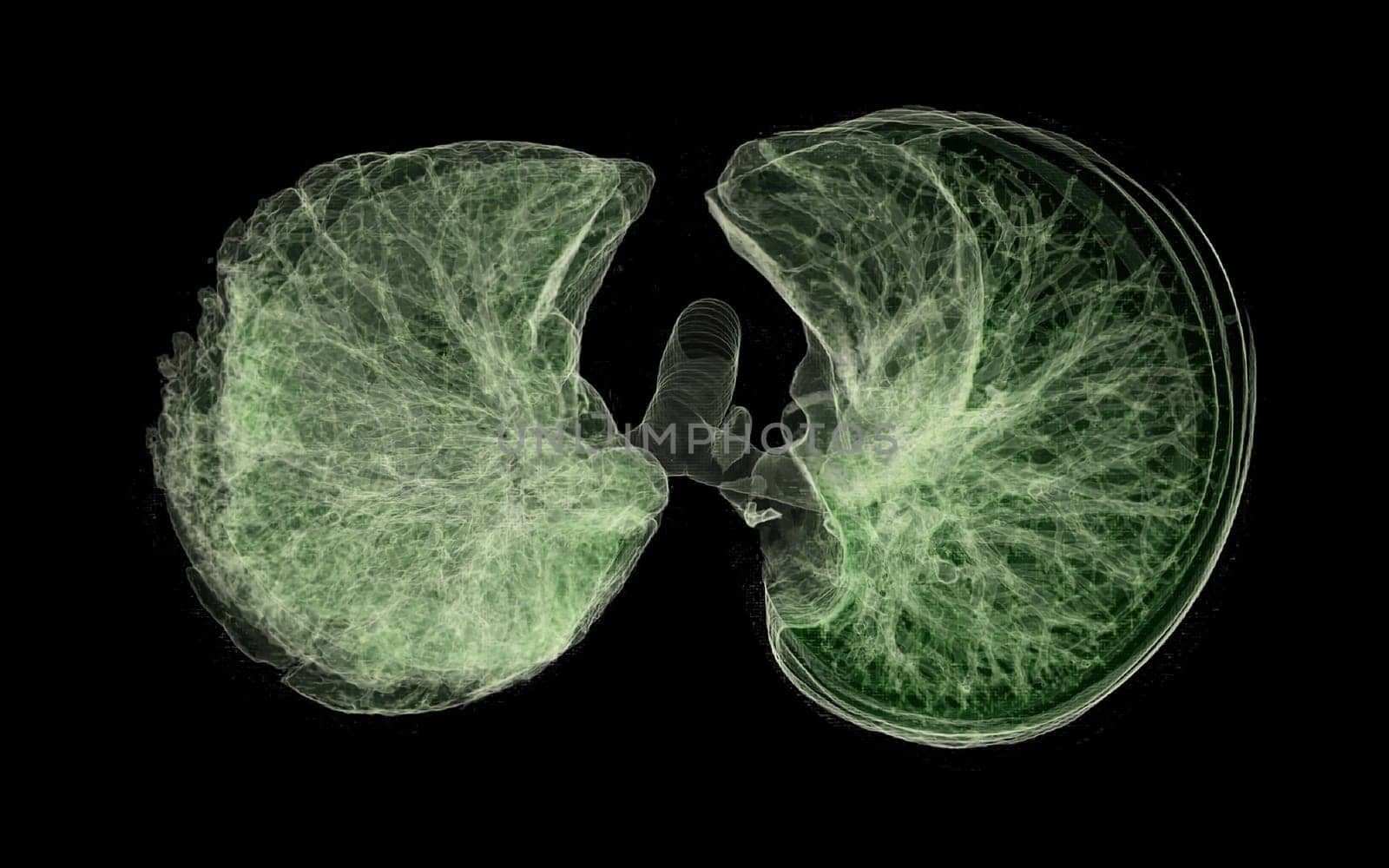 CT Chest or Lung 3D rendering image for diagnosis TB,tuberculosis and covid-19 .