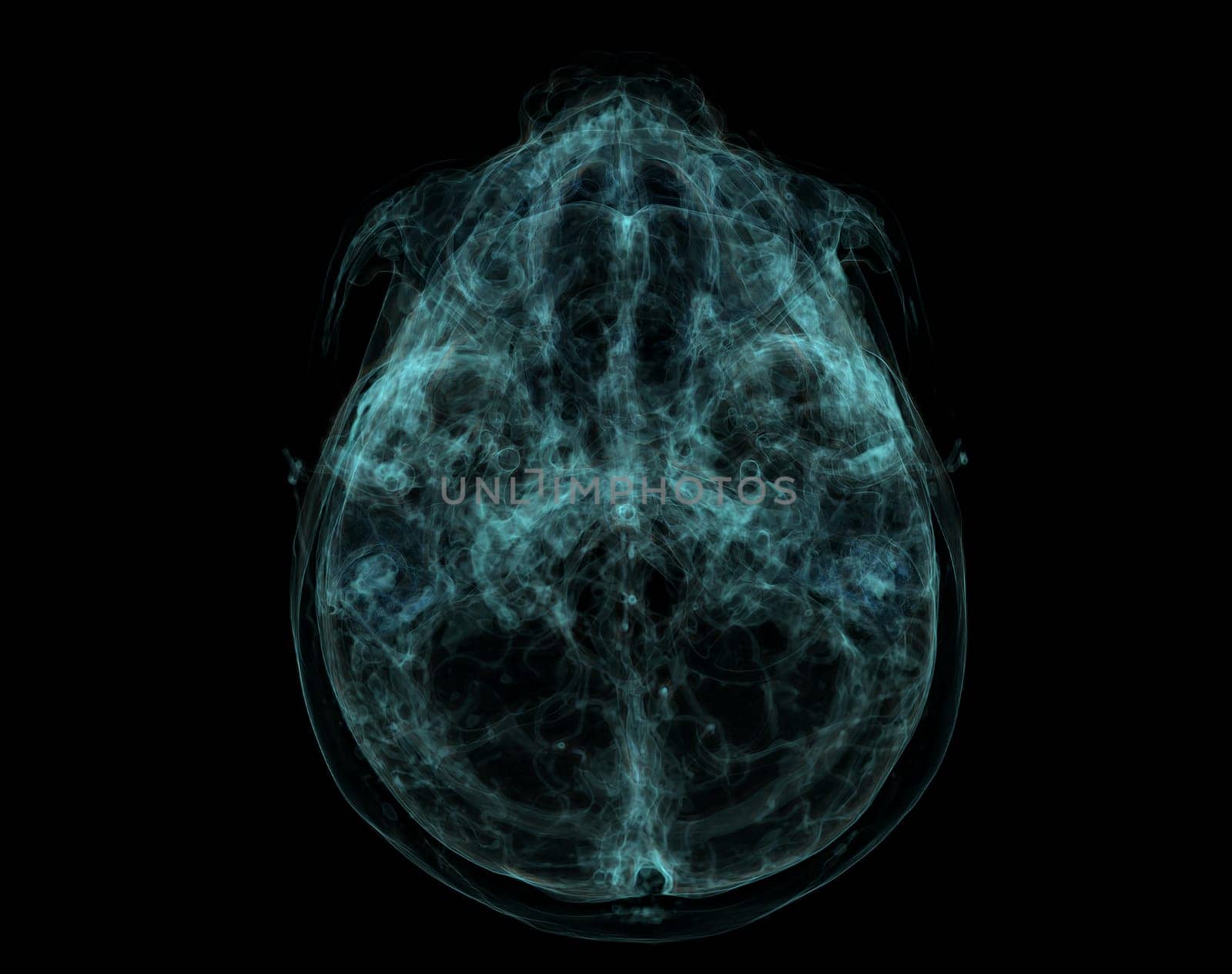 Human Skull, Brain by CT Scan. X-ray Visualization Inside Of Skull. 3D Illustration Render by samunella