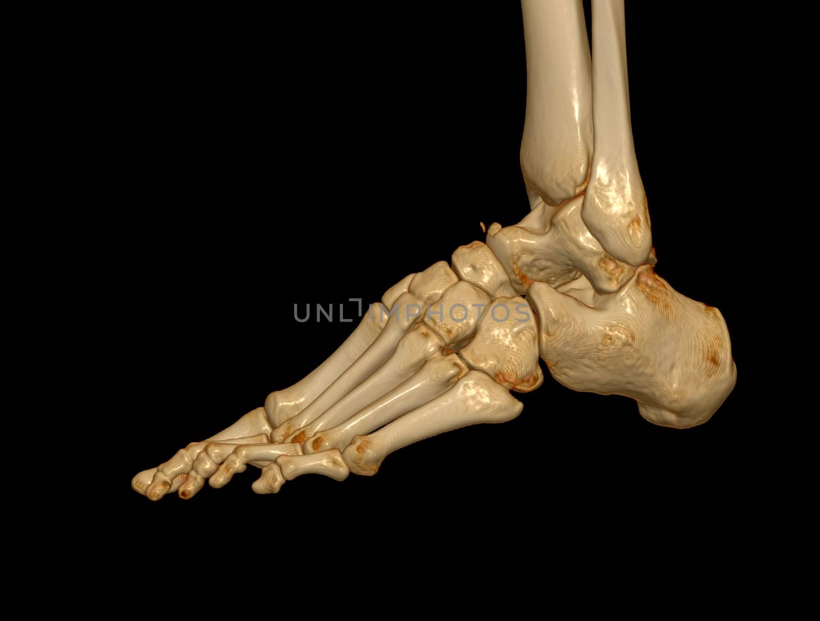 3D rendering of the foot bones for diagnosis bone fracture and rheumatoid arthritis from CT scannner.