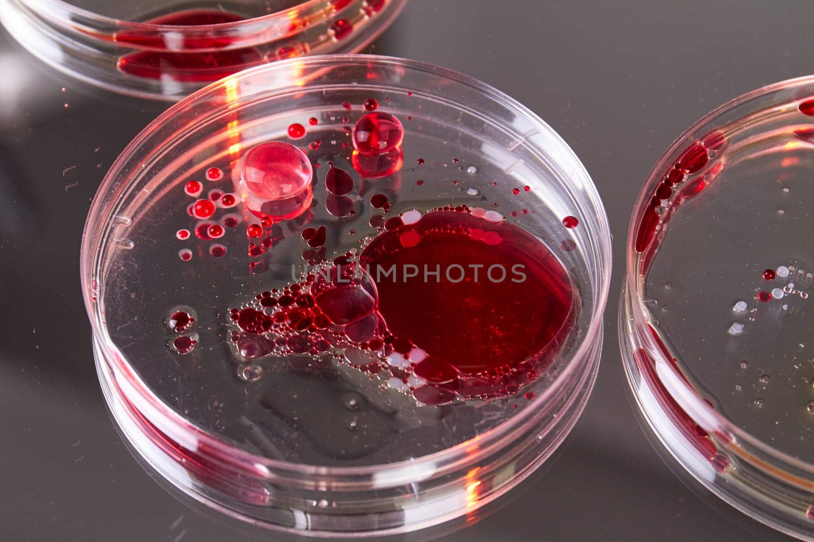 Close up lab petri dishes with blood samples. Agar for biological reserach.