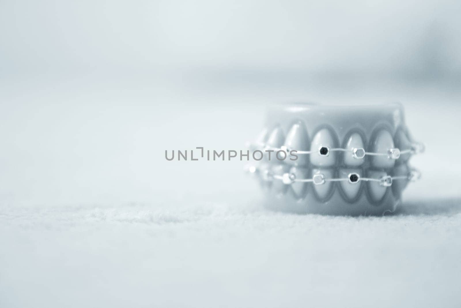 Metal orthodontic denture base. No people