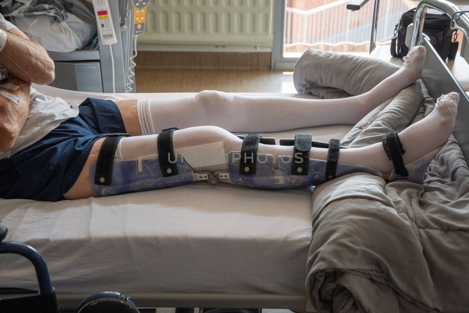 a man with a broken leg in an orthese in bed in a clinic after an accident, High quality photo
