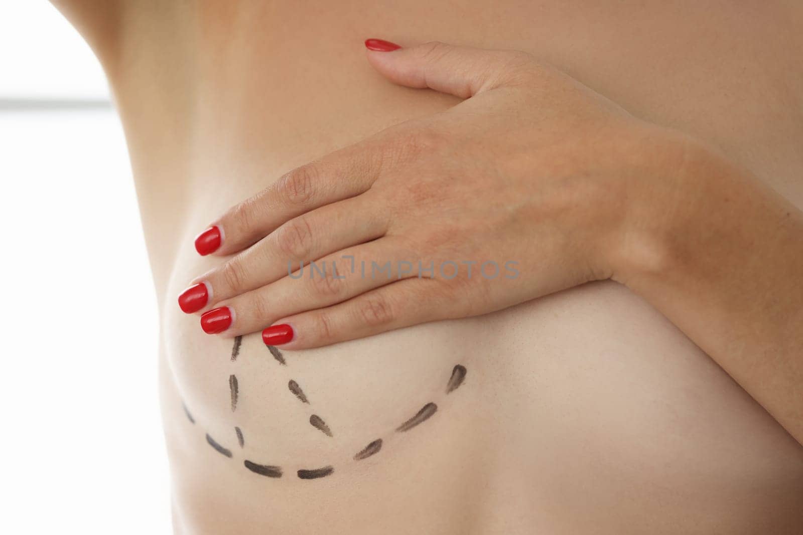 Breast correction and plastic surgery and small female breasts. Preparing for breast plastic surgery