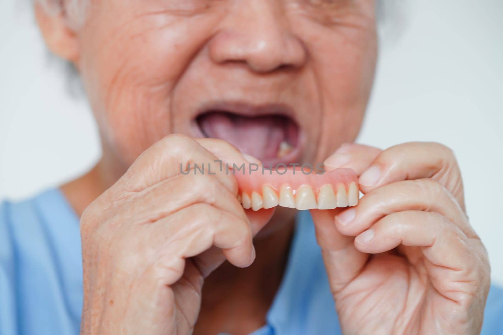 Asian senior woman patient wearing teeth denture into her mouth for chew food. by sweettomato