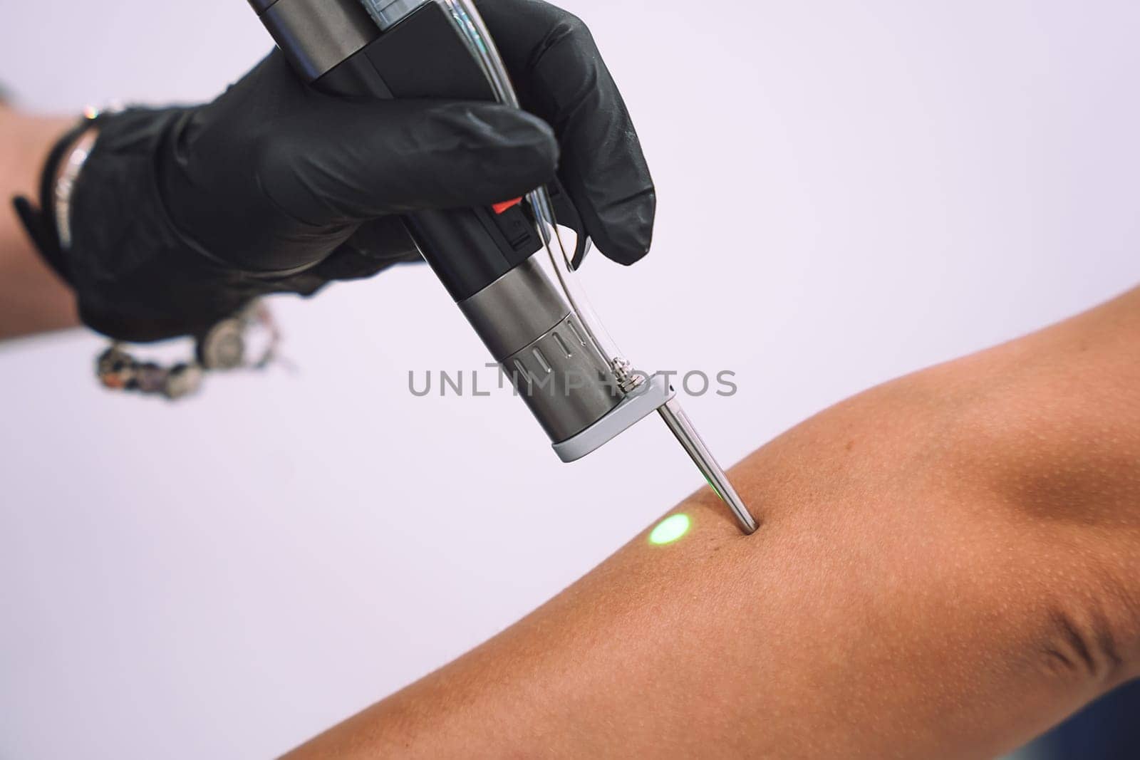 Close up shot of gloved hand with the laser hair removal machine's handpiece along woman hand. Alexandrite laser techhnology removing hair. Beauty procedureBeauty technology concept