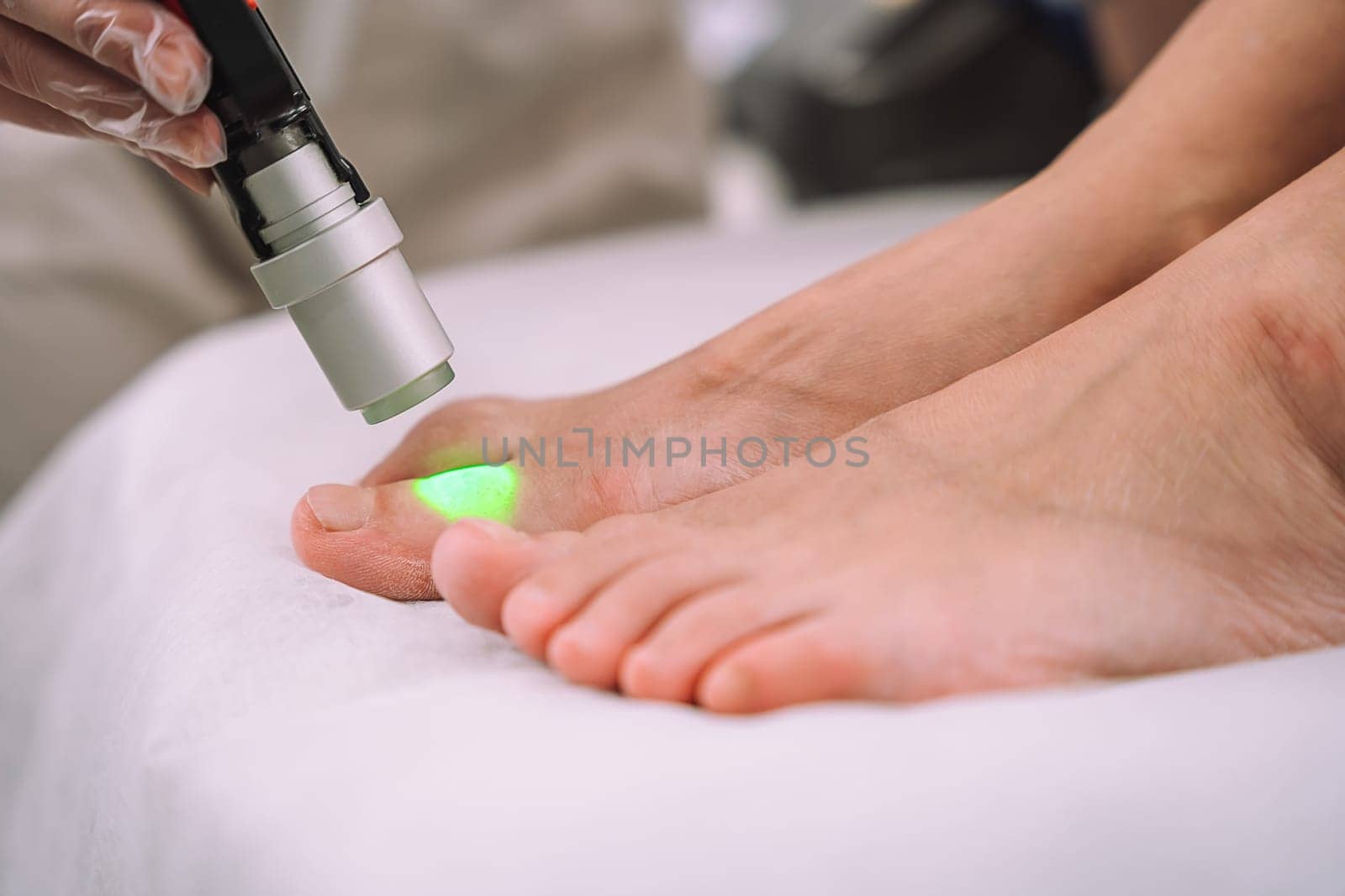 Close up shot of gloved hand with the laser hair removal machine's handpiece along woman leg. Alexandrite laser techhnology removing hair. Beauty procedureBeauty technology concept