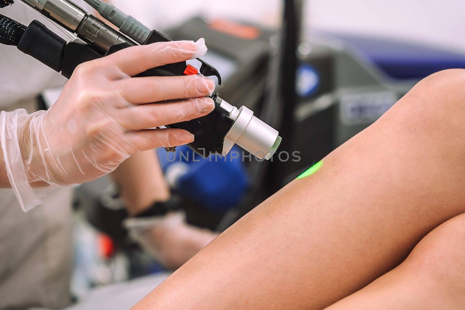 Close up shot of gloved hand with the laser hair removal machine's handpiece along woman leg. Alexandrite laser techhnology removing hair. Beauty procedureBeauty technology concept