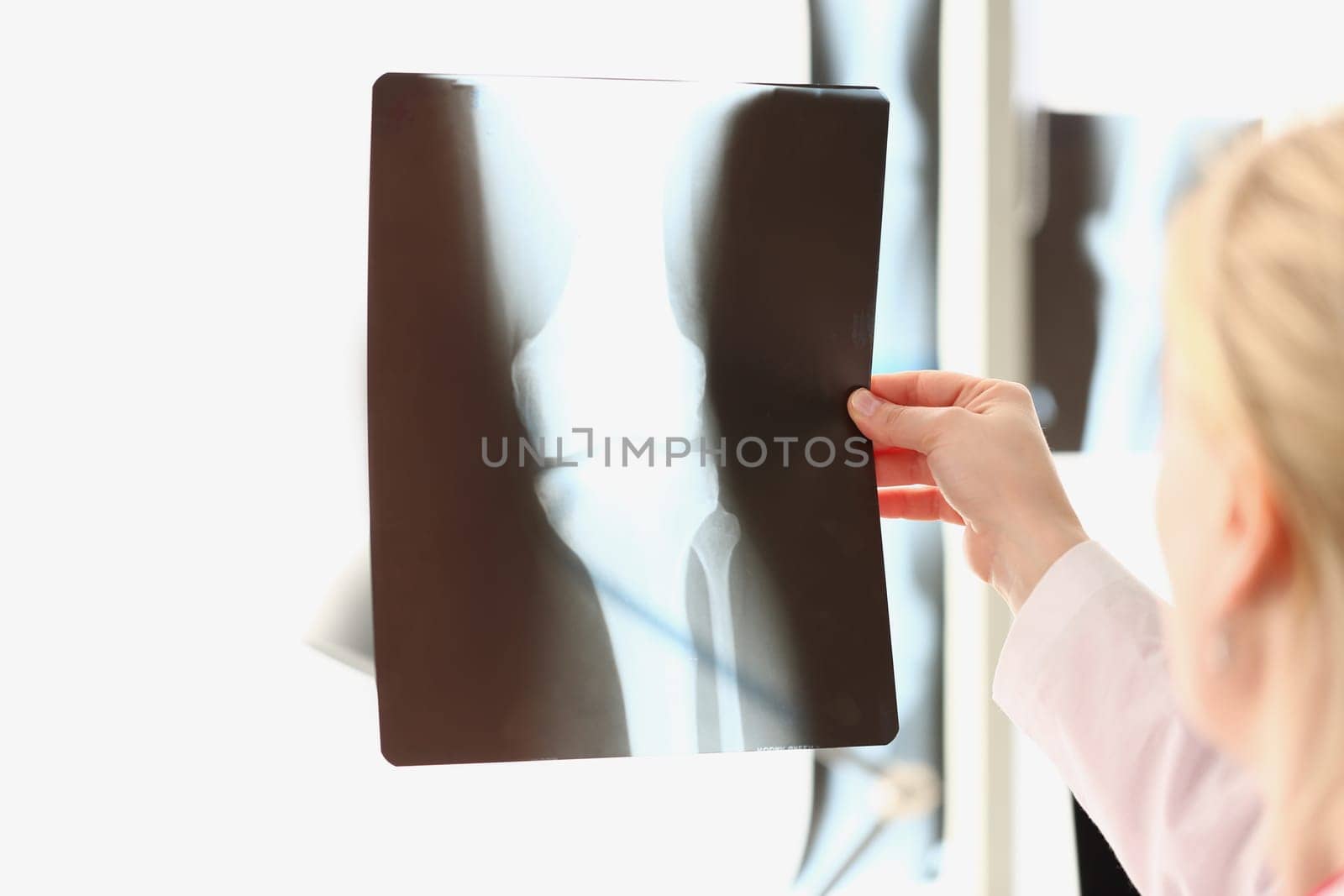 Doctor looks at x-ray film of knee joint before treatment. Image of bone in orthopedic department of hospital concept